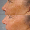 LumaPro-C Face Serum