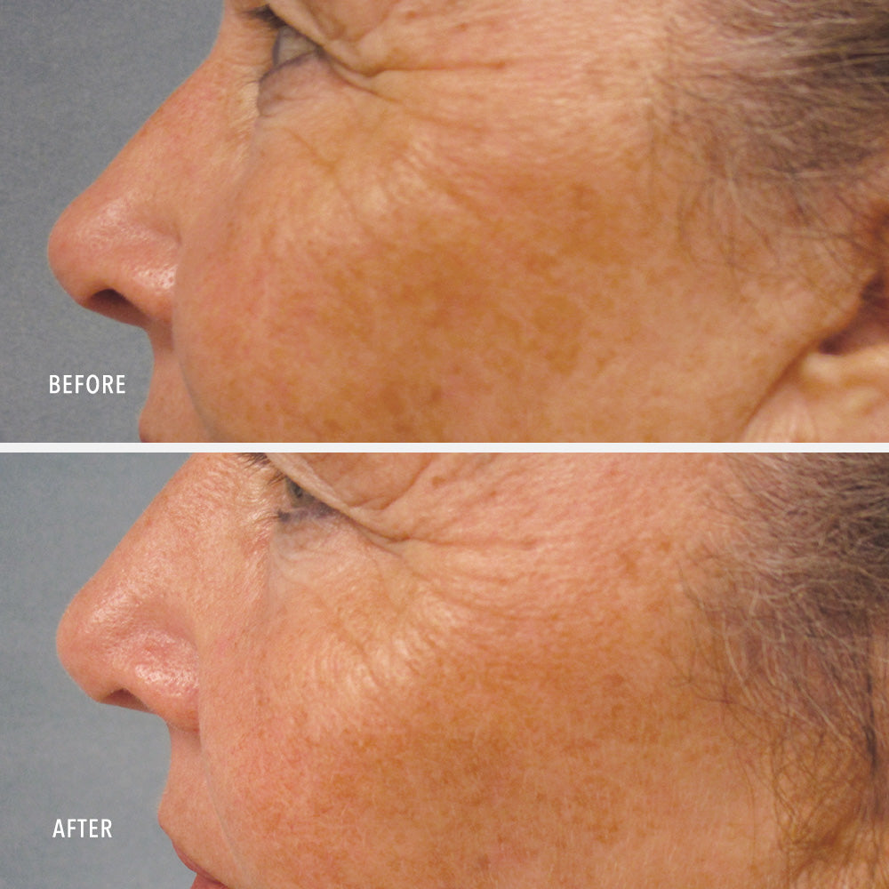 LumaPro-C Face Serum