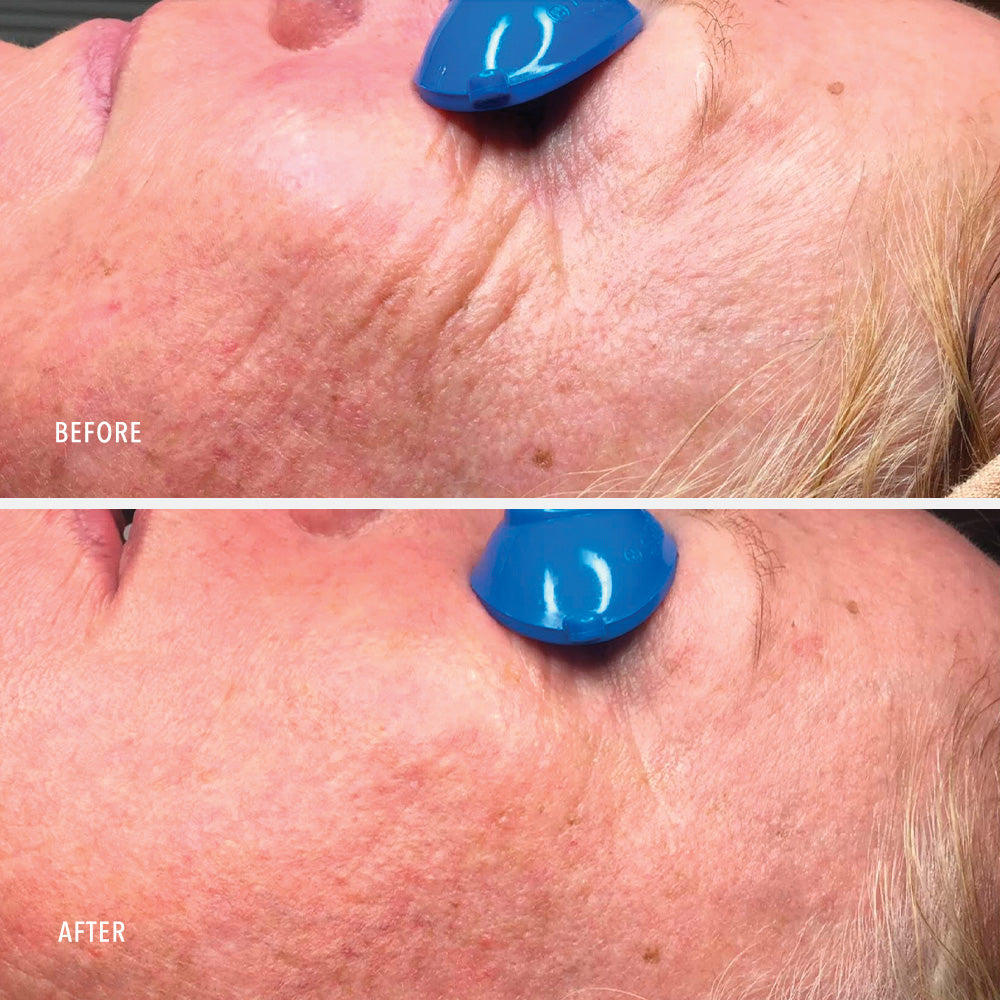 Travel Collagen ReActivate PM