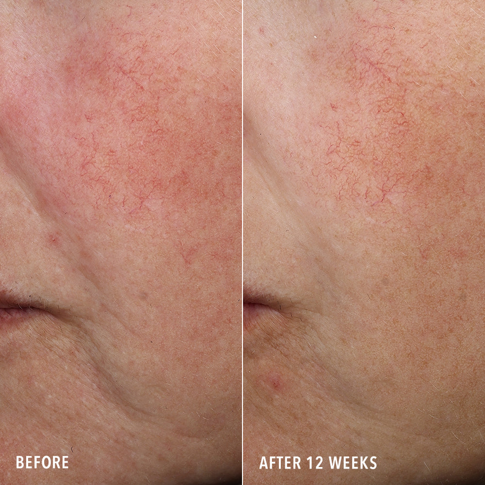 Travel Syner-C Serum